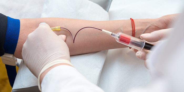 Injection et prélèvement